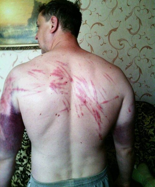 Пастор из Донецка рассказал об избиениях в плену у боевиков (фото)